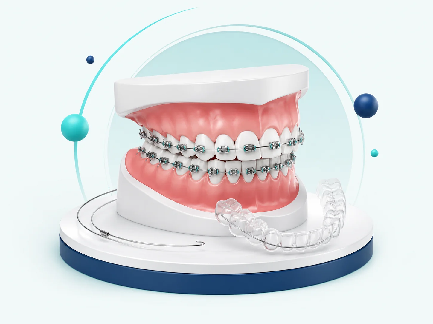 Orthodontic dental model showing braces and clear aligner treatment