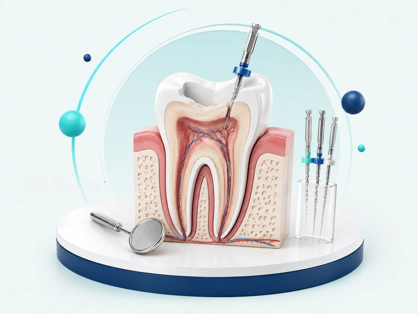 Cross-section tooth model with endodontic instruments used in root canal treatment